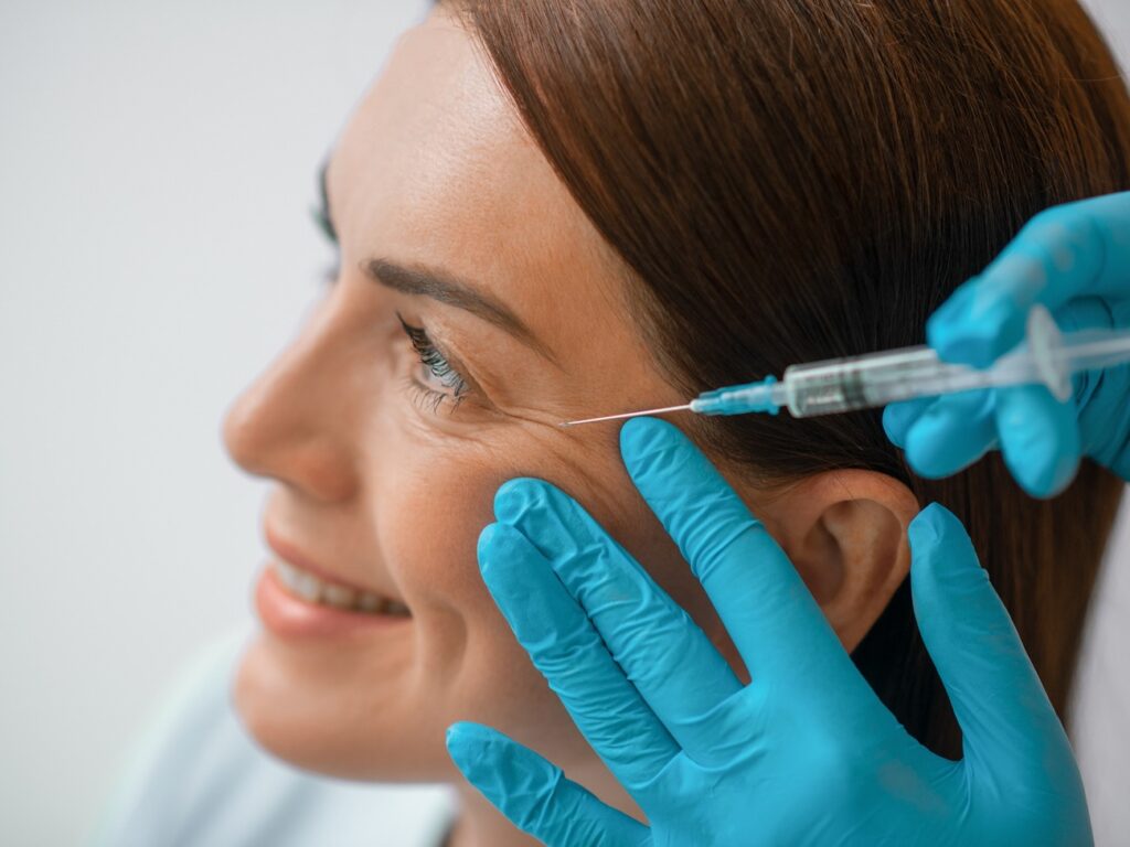Aplicación de botox en las patas de gallo