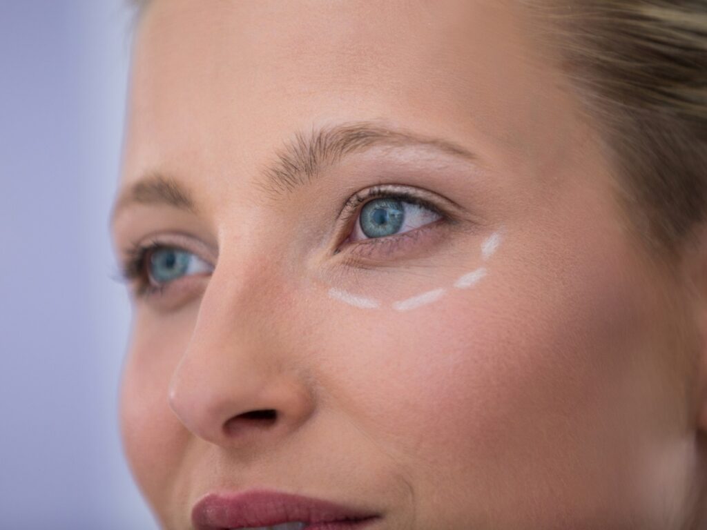 Primer plano del contorno de ojos tras el aclaramiento de ojeras
