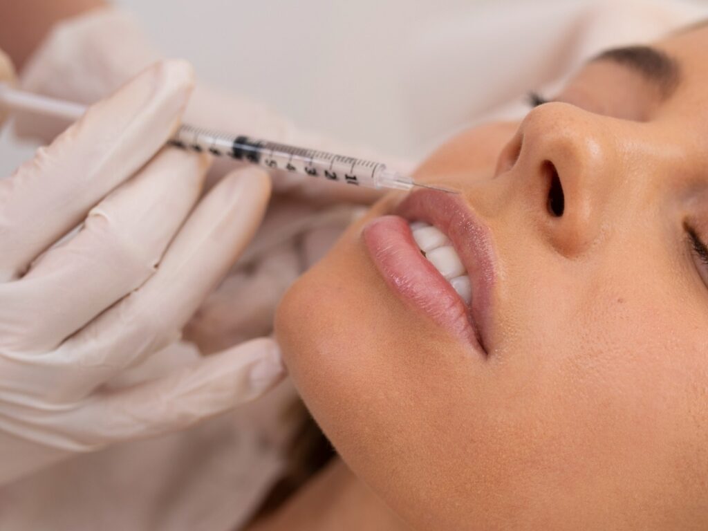 Inyección de ácido hialurónico en los labios
