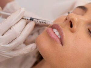 Inyección de ácido hialurónico en los labios